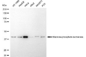 anti-Mannose Phosphate Isomerase (MPI) antibody