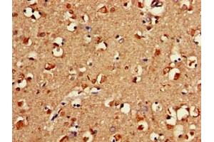 Immunohistochemistry of paraffin-embedded human brain tissue using ABIN7152652 at dilution of 1:100 (FAAH antibody  (AA 205-342))