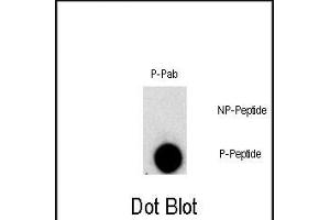 Dot blot analysis of Phospho-FGFR1- polyclonal antibody `a on nitrocellulose membrane. (FGFR1 antibody  (pTyr307))