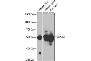 Western blot analysis of extracts of various cell lines using ADCK3 Polyclonal Antibody at dilution of 1:1000. (COQ8A antibody)