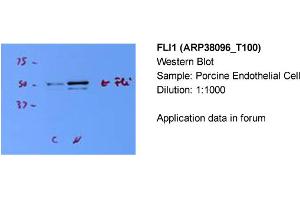 Western Blotting (WB) image for anti-Friend Leukemia Virus Integration 1 (FLI1) (N-Term) antibody (ABIN2780392) (FLI1 antibody  (N-Term))