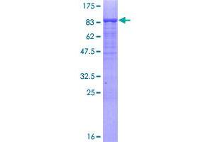 MSL3 Protein (AA 1-521) (GST tag)