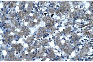 Rabbit Anti-SUPT3H Antibody Catalog Number: ARP30038 Paraffin Embedded Tissue: Human Liver Cellular Data: Hepatocytes Antibody Concentration: 4. (SUPT3H/SPT3 antibody  (N-Term))