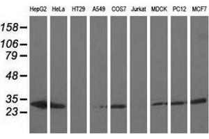 Western blot analysis of extracts (35 µg) from 9 different cell lines by using anti-AK3 monoclonal antibody. (Adenylate Kinase 3 antibody)
