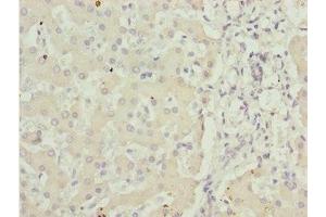 Immunohistochemistry of paraffin-embedded human liver tissue using ABIN7143435 at dilution of 1:100 (ADPGK antibody  (AA 218-497))