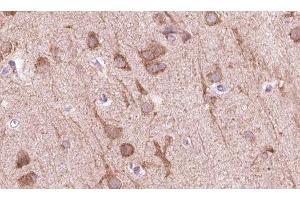 ABIN6273836 at 1/100 staining human brain tissue sections by IHC-P. (5HT1D antibody  (Internal Region))