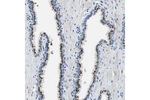 Immunohistochemical staining of human prostate with C16orf79 polyclonal antibody  shows strong cytoplasmic positivity, with a granular pattern, in glandular cells.