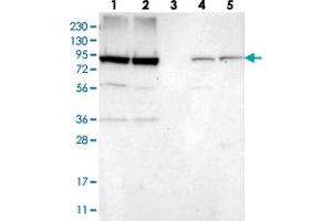Western blot analysis of Lane 1: RT-4, Lane 2: U-251 MG, Lane 3: Human Plasma, Lane 4: Liver, Lane 5: Tonsil with NUP93 polyclonal antibody . (NUP93 antibody)