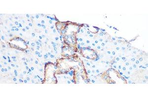 Immunohistochemistry of paraffin-embedded Mouse kidney using YTHDF2 Polyclonal Antibody at dilution of 1:100 (40x lens).