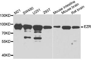 Western blot analysis of extracts of various cell lines, using EZR antibody. (Ezrin antibody)