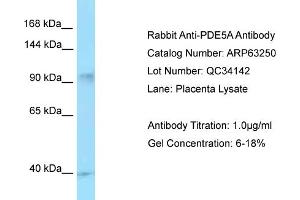 Western Blotting (WB) image for anti-phosphodiesterase 5A, cGMP-Specific (PDE5A) (C-Term) antibody (ABIN2789423) (PDE5A antibody  (C-Term))