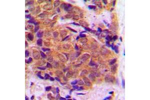 Immunohistochemistry (IHC) image for anti-Eukaryotic Translation Initiation Factor 4E (EIF4E) (C-Term) antibody (ABIN7295572)