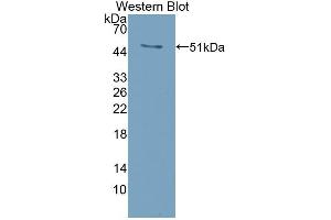 Detection of Recombinant RANkL, Mouse using Polyclonal Antibody to Receptor Activator Of Nuclear Factor Kappa B Ligand (RANkL) (RANKL antibody  (AA 92-263))
