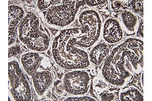Immunohistochemistry (IHC) image for anti-Parkinson Protein 7 (PARK7) (C-Term) antibody (ABIN184951)