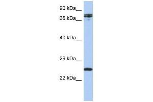 HNF1A antibody used at 0. (HNF1A antibody  (N-Term))