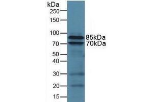 Detection of CD18 in Human U937 Cells using Polyclonal Antibody to Integrin Beta 2 (CD18) (Integrin beta 2 antibody  (AA 451-627))