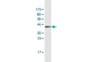 Western Blot detection against Immunogen (38. (HOXA5 antibody  (AA 91-200))