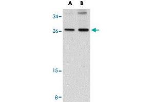 Western blot analysis of SCAMP4 in NIH/3T3 cell lysate with SCAMP4 polyclonal antibody  at (A) 1 and (B) 2 ug/mL . (SCAMP4 antibody  (C-Term))