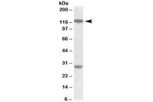 Western blot testing of MOLT4 lysate with UBN1 antibody at 1ug/ml. (Ubinuclein 1 antibody)