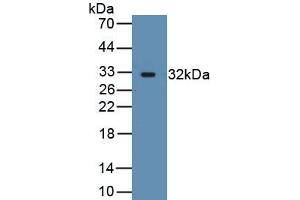 Detection of Recombinant ACTN3, Human using Polyclonal Antibody to Actinin Alpha 3 (ACTN3) (ACTN3 antibody  (AA 162-416))