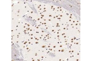 Immunohistochemistry analysis of paraffin-embedded rat brain using,SNRPD2 (ABIN7075634) at dilution of 1: 1600 (SNRPD2 antibody)