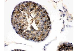 IHC analysis of Hsp90 alpha using anti-Hsp90 alpha antibody (ABIN3043848).
