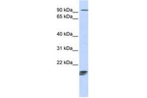 Image no. 1 for anti-Immature Colon Carcinoma Transcript 1 (ICT1) (AA 108-157) antibody (ABIN6743781)