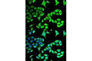 Immunofluorescence analysis of MCF-7 cells using GABARAP antibody (ABIN5973270). (GABARAP antibody)