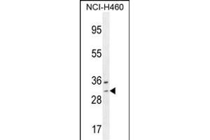 WBSCR27 Antibody (N-term) (ABIN654505 and ABIN2844234) western blot analysis in NCI- cell line lysates (35 μg/lane).
