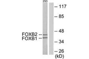 Western blot analysis of extracts from 293 cells, using FOXB1/2 Antibody. (FOXB1/2 antibody  (AA 51-100))
