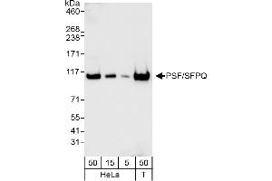 Western Blotting (WB) image for anti-Splicing Factor Proline/glutamine-Ric (SFPQ) (AA 1-50) antibody (ABIN7453760) (SFPQ antibody  (AA 1-50))