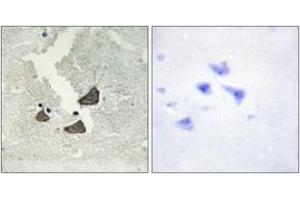 Immunohistochemistry analysis of paraffin-embedded human brain tissue, using EPHB6 Antibody. (EPH Receptor B6 antibody  (AA 861-910))