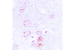 Immunohistochemical analysis of EPB41L2 staining in human brain formalin fixed paraffin embedded tissue section. (EPB41L2 antibody  (Center))