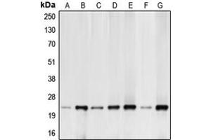 Western blot analysis of BIM expression in HeLa (A), K562 (B), Raji (C), HEK293T (D), MCF7 (E), mouse kidney (F), rat kidney (G) whole cell lysates.