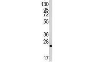 Western blot analysis of Bid antibody and mouse lung tissue lysate (BID antibody  (AA 68-103))
