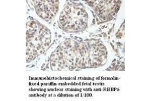 Image no. 1 for anti-Retinoblastoma Binding Protein 6 (RBBP6) antibody (ABIN791194) (RBBP6 antibody)