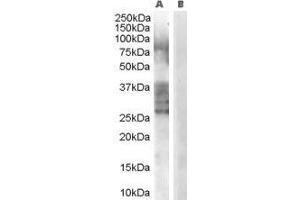 Western Blotting (WB) image for ADAM Metallopeptidase Domain 33 (ADAM33) peptide (ABIN369714)