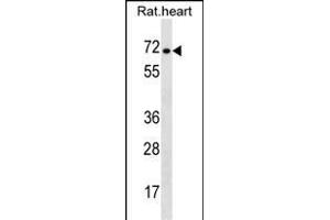 Rat Stra6 Antibody (C-term) (ABIN1537393 and ABIN2850195) western blot analysis in rat heart tissue lysates (35 μg/lane).