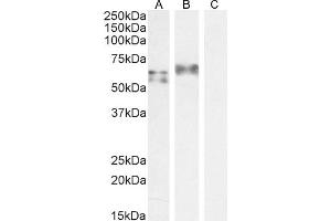 ABIN184812 staining (1 μg/mL) Human Spleen (A) and A549 cell lysate (B) + peptide (C). (IRF5 antibody  (C-Term))