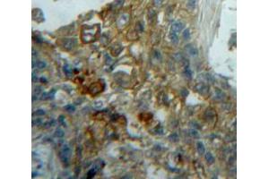 Used in DAB staining on fromalin fixed paraffin-embedded Lung tissue (ECE1 antibody  (AA 214-448))