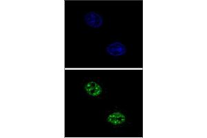 Confocal immunofluorescent analysis of USF1 Antibody (Center) with Hela cell followed by Alexa Fluor 488-conjugated goat anti-rabbit lgG (green). (USF1 antibody  (Middle Region))