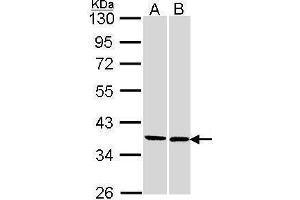 WB Image Sample (30 ug of whole cell lysate) A: 293T B: H1299 10% SDS PAGE antibody diluted at 1:1000 (FAM50A antibody)