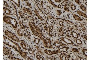 ABIN6277736 at 1/100 staining Human kidney tissue by IHC-P. (GLI1 antibody  (C-Term))