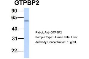 Host:  Rabbit  Target Name:  GTPBP2  Sample Type:  Human Fetal Liver  Antibody Dilution:  1. (GTPBP2 antibody  (N-Term))