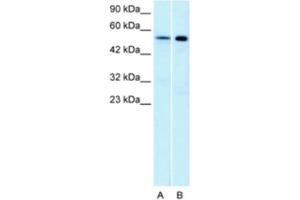 Western Blotting (WB) image for anti-Serotonin Receptor 1A (HTR1A) antibody (ABIN2463750) (Serotonin Receptor 1A antibody)