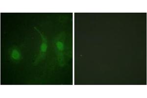 Immunofluorescence analysis of HeLa cells, using IRF3 (Phospho-Ser385) antibody.