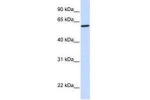 Image no. 1 for anti-Cytochrome P450, Family 27, Subfamily A, Polypeptide 1 (CYP27A1) (AA 432-481) antibody (ABIN6741109)