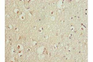 Immunohistochemistry of paraffin-embedded human brain tissue using ABIN7165174 at dilution of 1:100 (TNRC5 antibody  (AA 31-278))