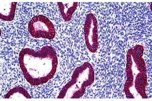 Human Uterus, Endometrium: Formalin-Fixed, Paraffin-Embedded (FFPE) (EpCAM antibody)