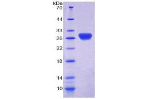 SDS-PAGE (SDS) image for Thioredoxin Reductase 1 (TXNRD1) (AA 208-433) protein (His tag) (ABIN2126948) (TXNRD1 Protein (AA 208-433) (His tag))